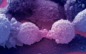 Cancer Cells Under Microscope